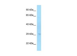 ELOVL6 Rabbit anti-Human, Polyclonal, Novus Biologicals 0.1 mL; Unconjugated:Antibodies,